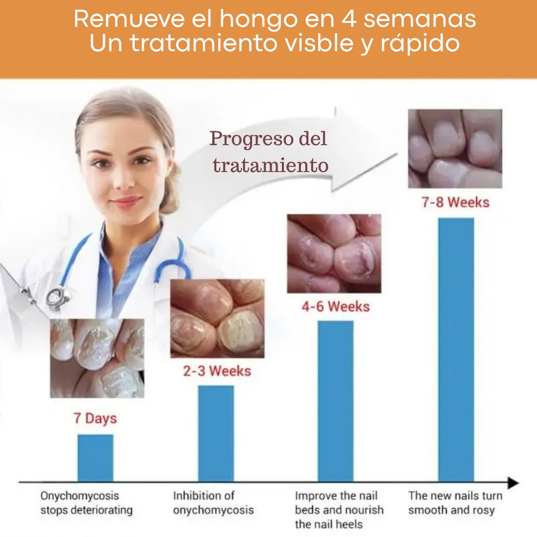 Removedor Hongos y reparador Avanzado de Uñas 7 días base jengibre
