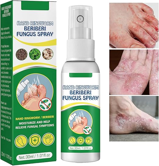 Micostop Terapéutico Herbal Spray antifúngico natural para hongos en pies, manos y articulaciones