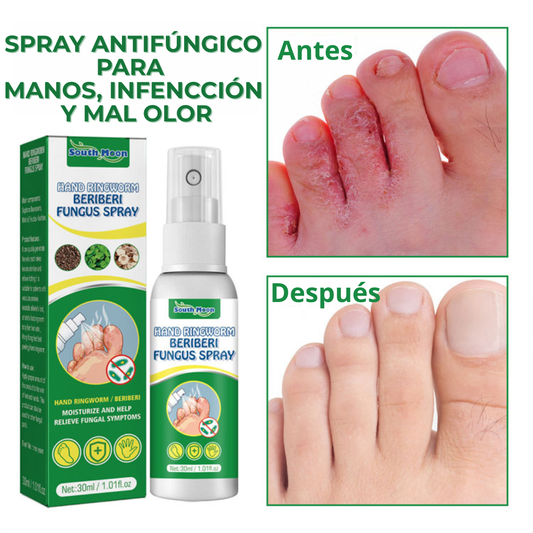 Micostop Terapéutico Herbal Spray antifúngico natural para hongos en pies, manos y articulaciones