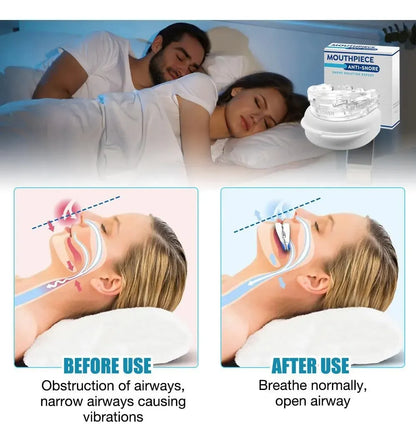 Boquilla Anti-Ronquidos Ajustable – Solución para Dormir Mejor