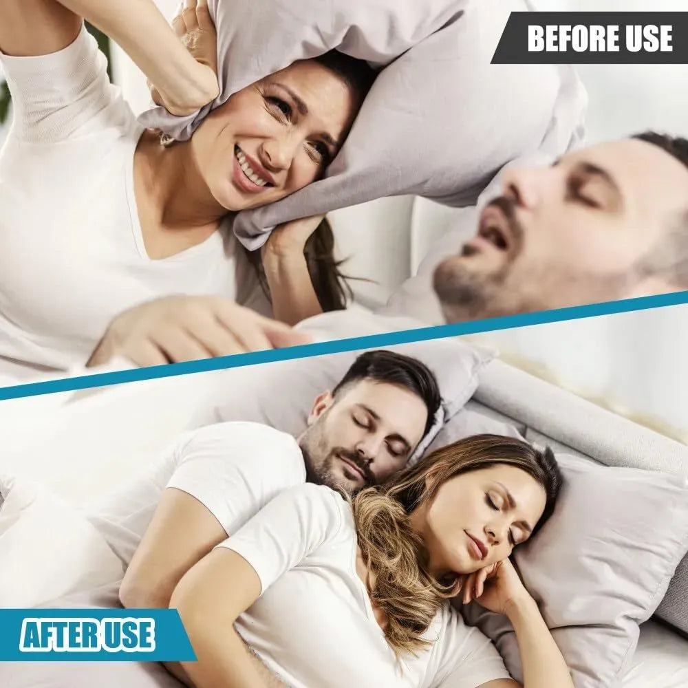 Boquilla Anti-Ronquidos Ajustable – Solución para Dormir Mejor
