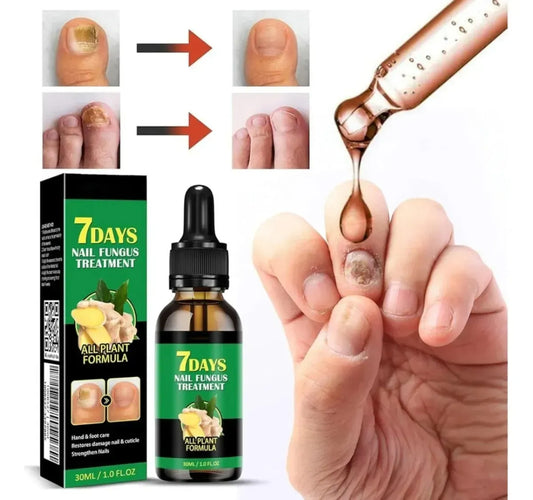 Removedor Hongos y reparador Avanzado de Uñas 7 días base jengibre